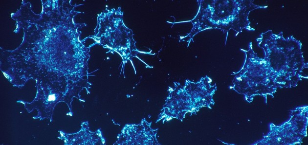 She Speaks: Either you’ll get cancer or you won’t | Commentary