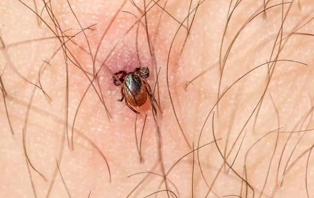 Stop ticks from taking a bite out of your time outdoors