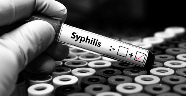 Rise in syphilis cases in Simcoe Muskoka a concerning trend