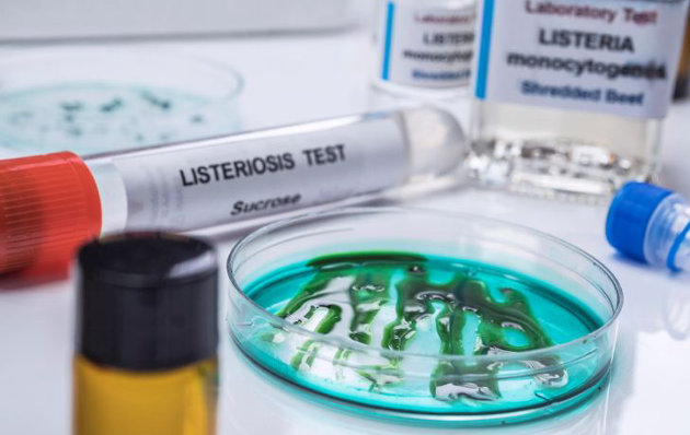 Chief Medical Officer of Health warns of recall due to possible Listeria contamination