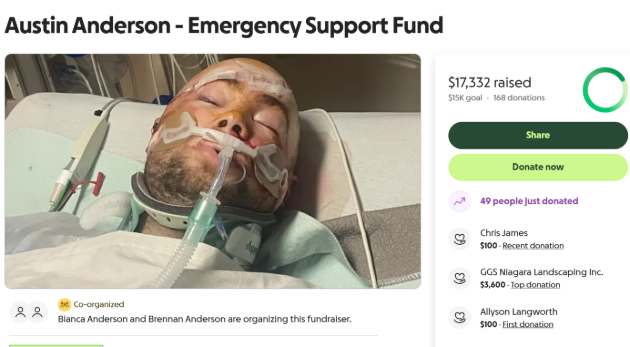 Fundraiser created for swimmer injured during a boating collision on Skeleton Lake