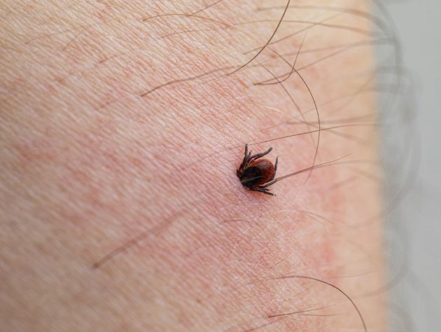 Residents reminded to guard against ticks
